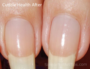 Pure™ Cuticle and Nail Oil results showing cuticle health