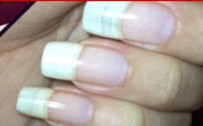 NAIL OIL – Pure Nail Oil™ Challenger Olga’s Results