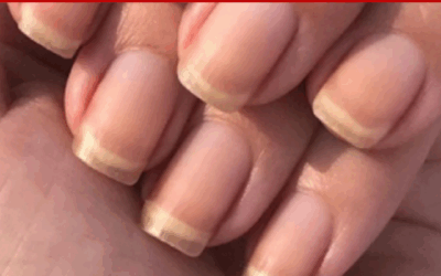 Clear Fingernails – Is It a Bad Thing?