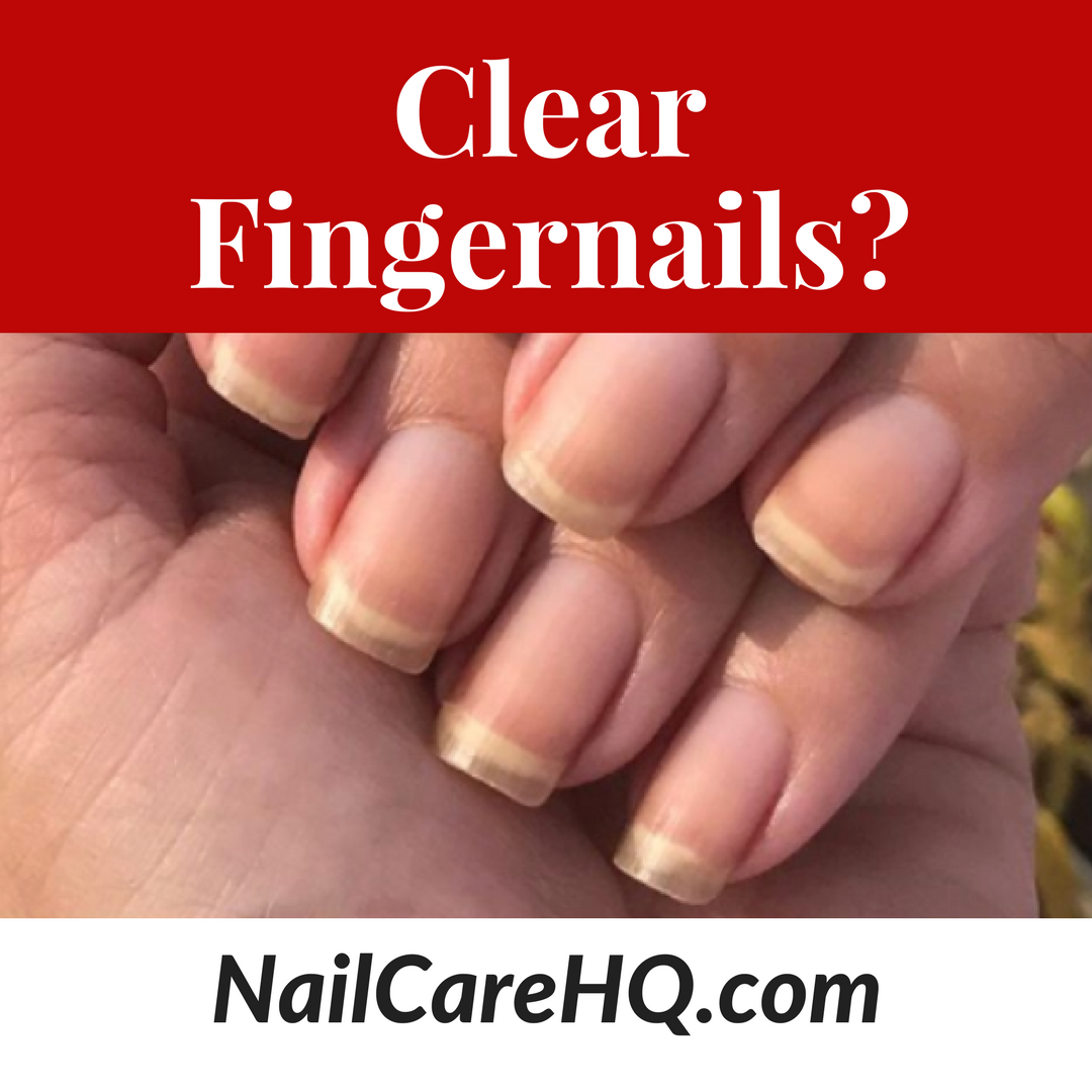 Clear Fingernails – Is It a Bad Thing?