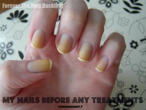 Yellow nails before using lemon juice to remove stains Marina FTYD