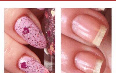 CUTICLE HEALTH – Pure Nail Oil™ Challenger Kimber’s Results