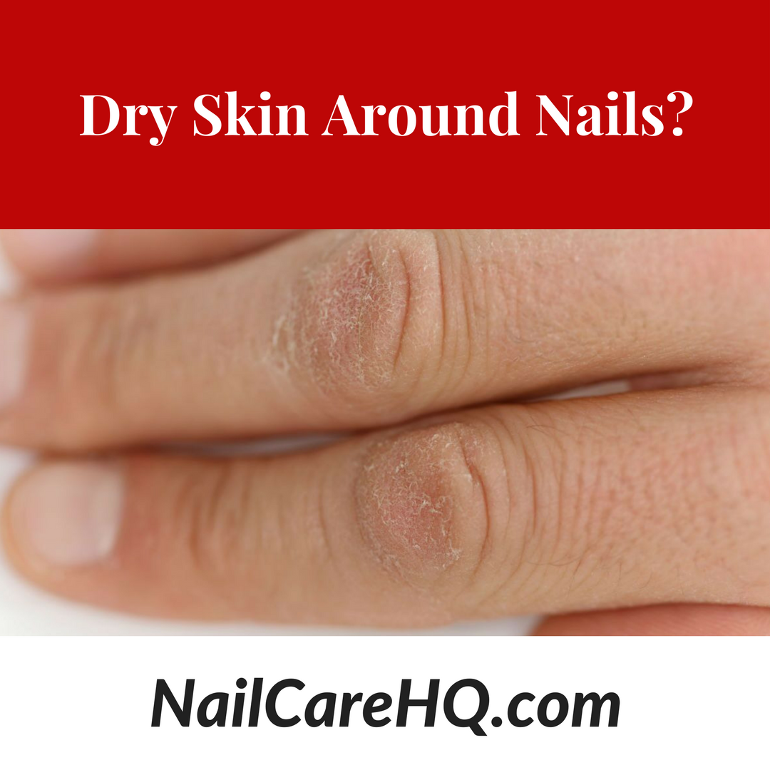 Ask Ana – How Do I Stop Hard, Dry Skin On Hands?