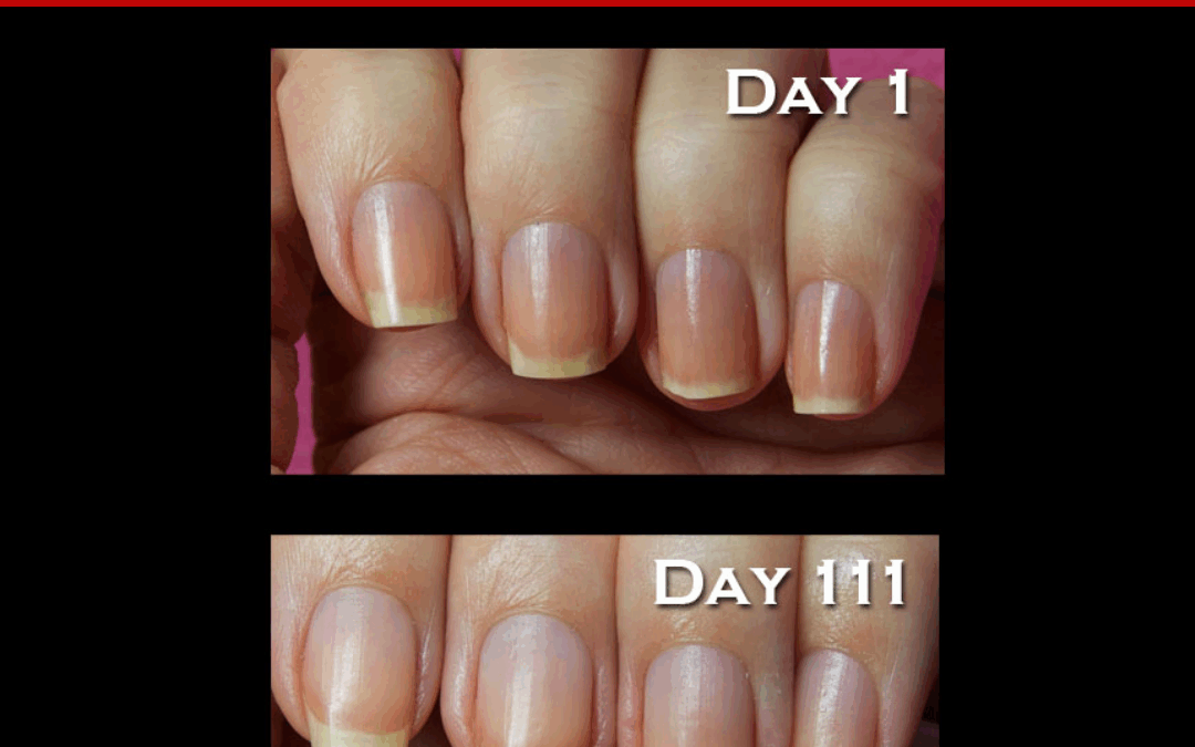 NAIL STRENGTHENER – Ana’s Simply Pure™ Nail Oil Challenge