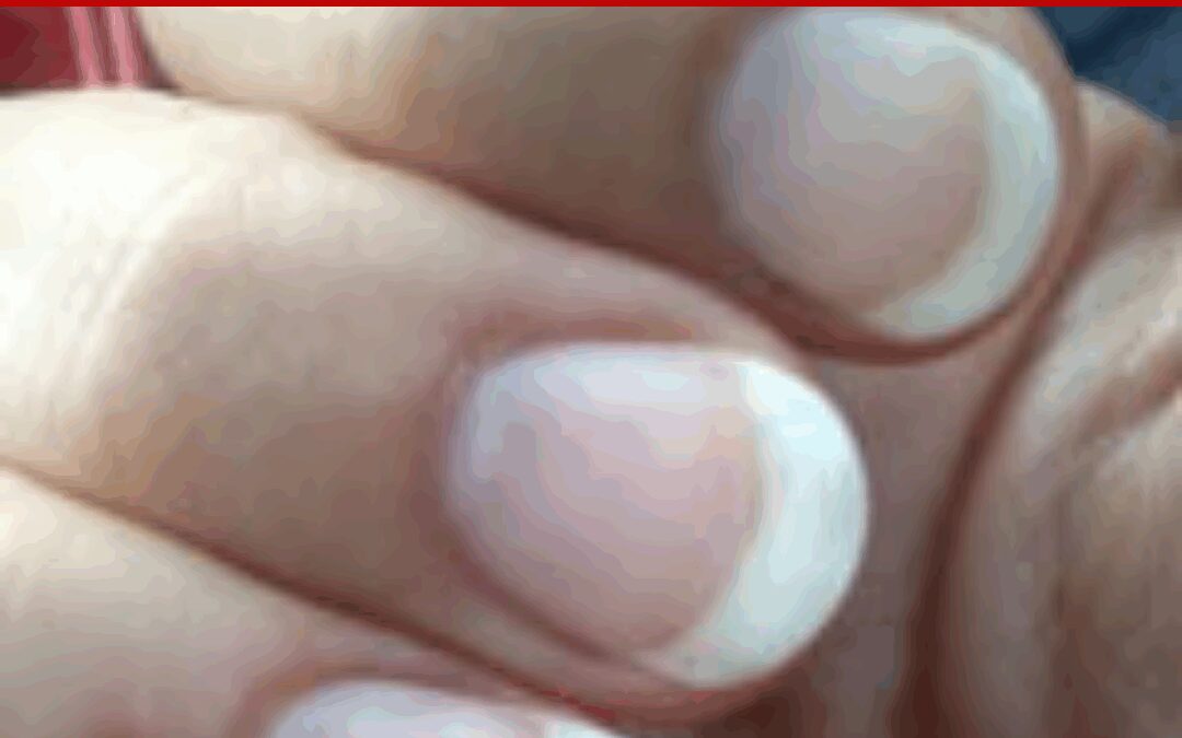 My Nails Made It Through the Airport – Kirsten’s Pure Nail Oil™ Challenge