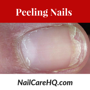 How to Stop Peeling Nails 