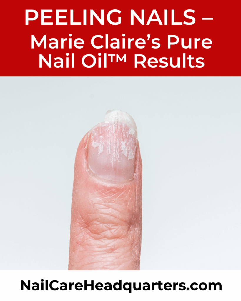 How to Stop Peeling Nails 
