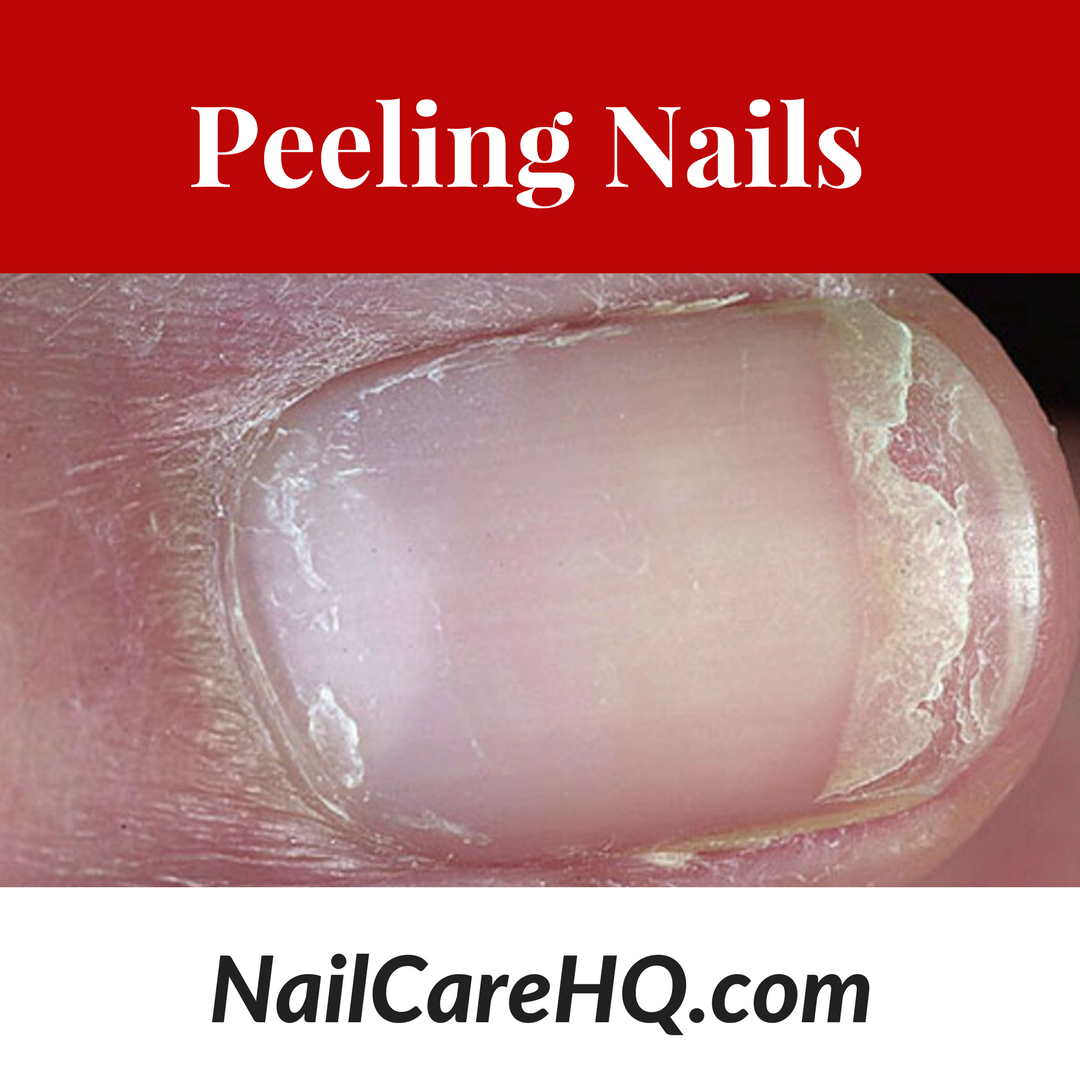 How to Stop Peeling Nails
