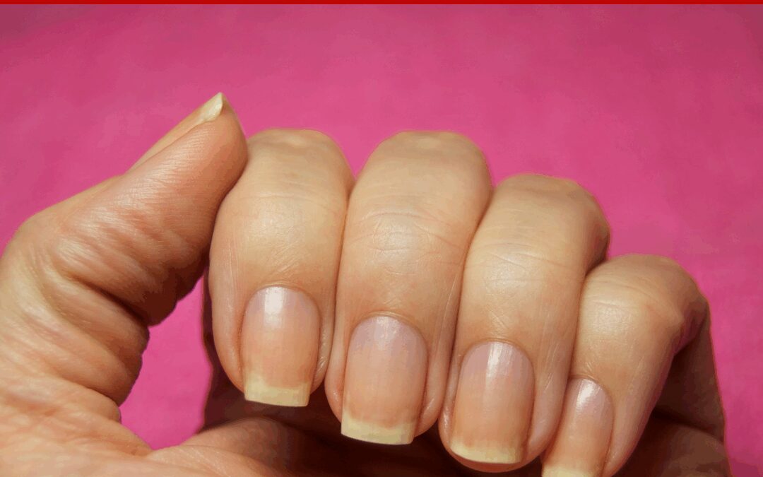 NAIL ANATOMY – Different Parts of Fingernail