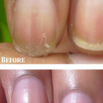 www.NailCareHQ.com Peeling nails - Marie Claire's Pure Nail Oil Challenge Results