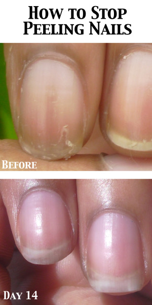 www.NailCareHQ.com Peeling nails - Marie Claire's Pure Nail Oil Challenge Results