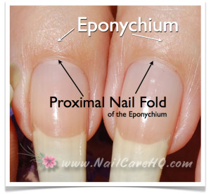 Cuticle - Proximal Fold of the Eponychium