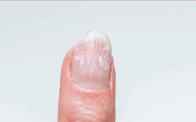 ASK ANA: Peeling Nails – Does Polish Prevent It?