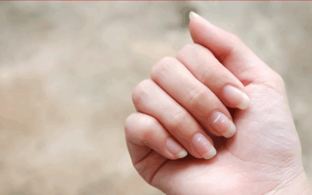 ASK ANA: White Spots On Nails