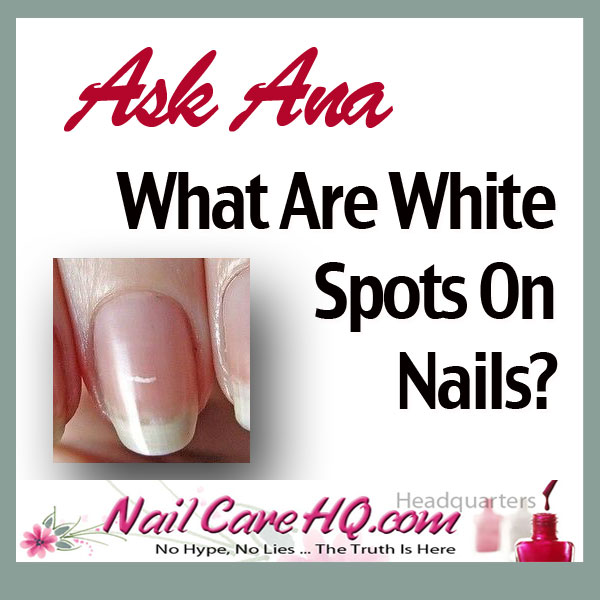 ASK ANA: White Spots On Nails