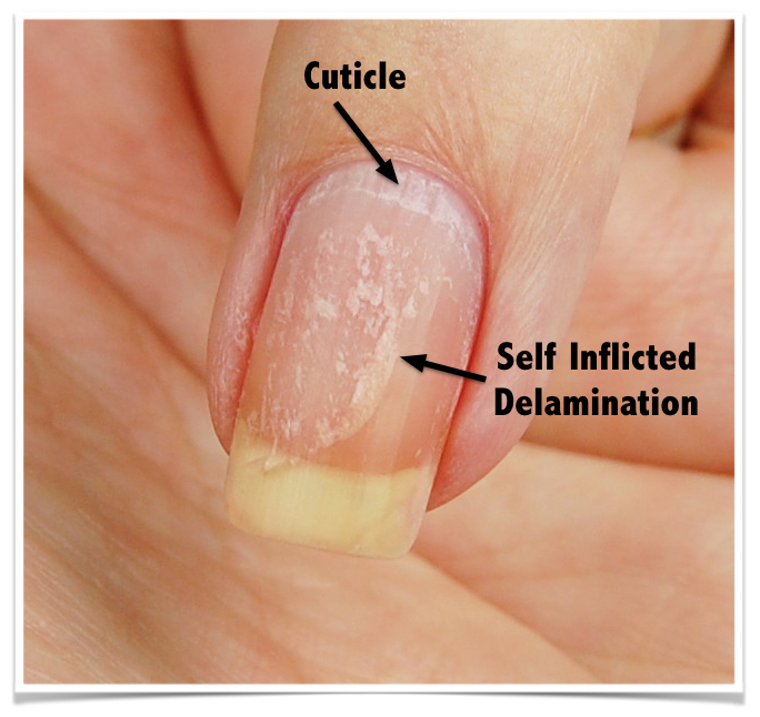 How to Stop Your Cuticles From Cracking and Peeling After a Manicure