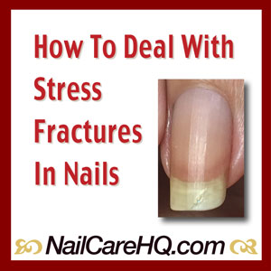 Stress Fractures In Nails