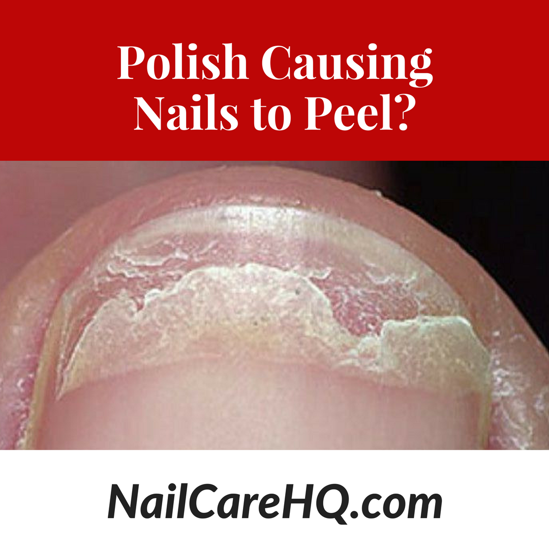 ASK DOUG: Peeling Nails – Is Polish Causing It?