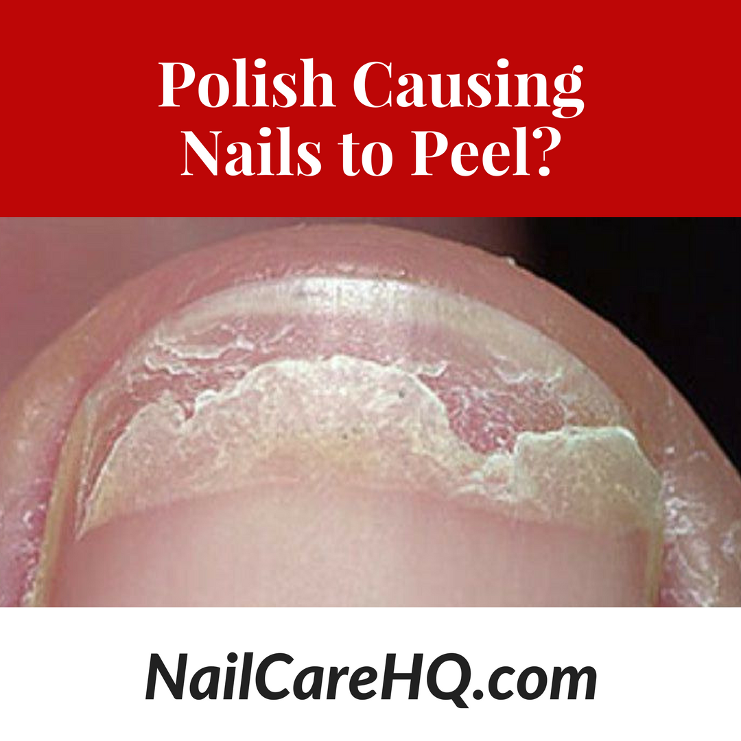 Is polish causing my nails to peel?