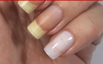 Broken Nail Repair – What To Do When It’s Bad