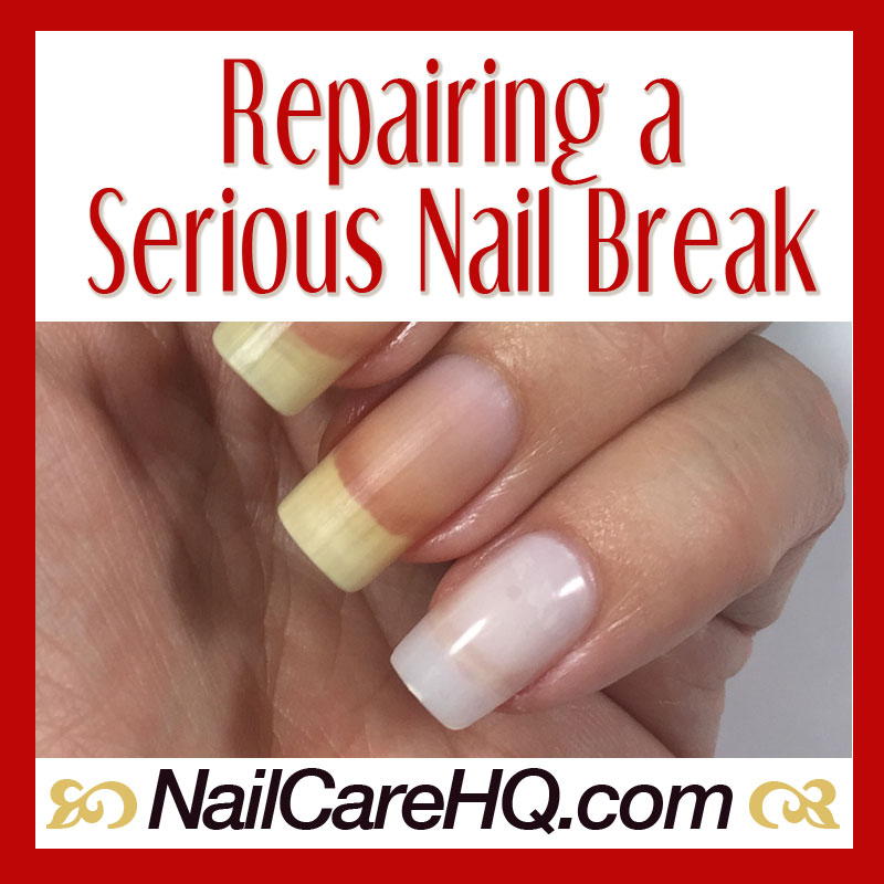 Broken Nail Repair – What To Do When It’s Bad
