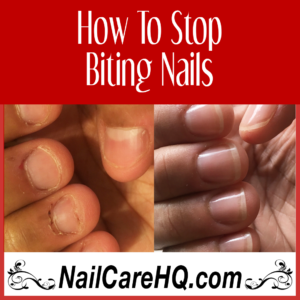 how to stop biting nails Angela's results