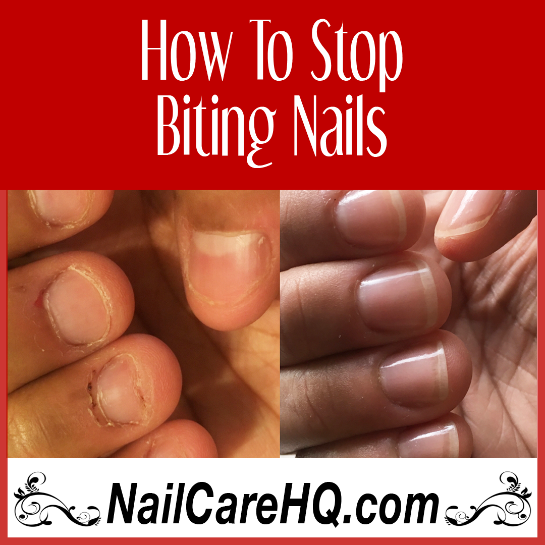 How To Stop Biting Nails – Angela’s Results