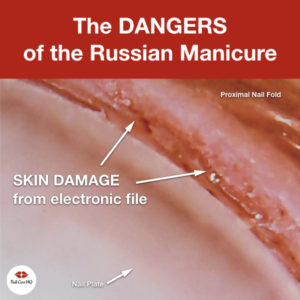 Russian Manicure Damage Microscopic Photos