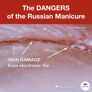 Russian Manicure Damage Microscopic Photos