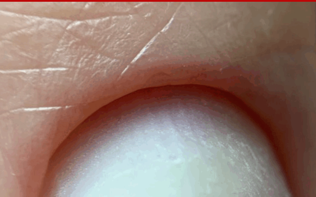 The Dangers of the Russian Manicure