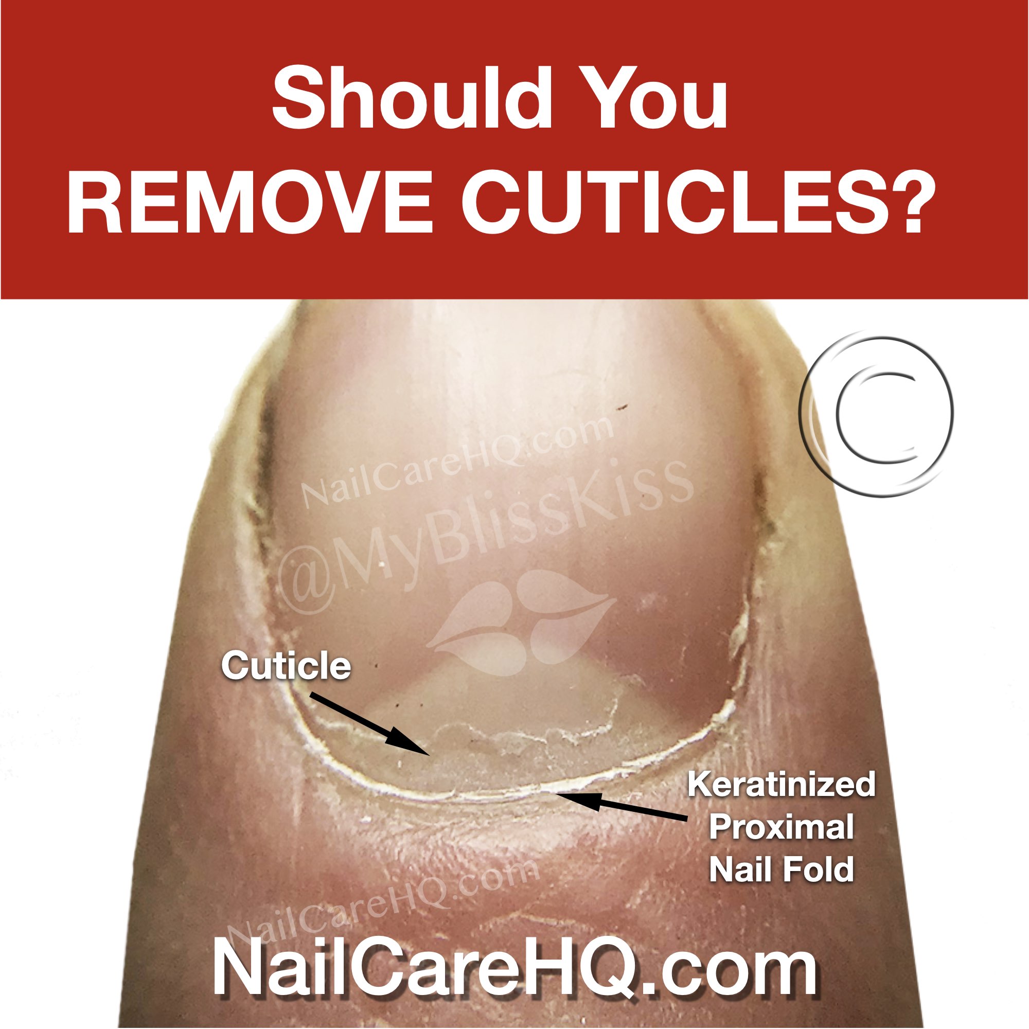 Article Title Image about if Should you remove cuticles nailcarehq