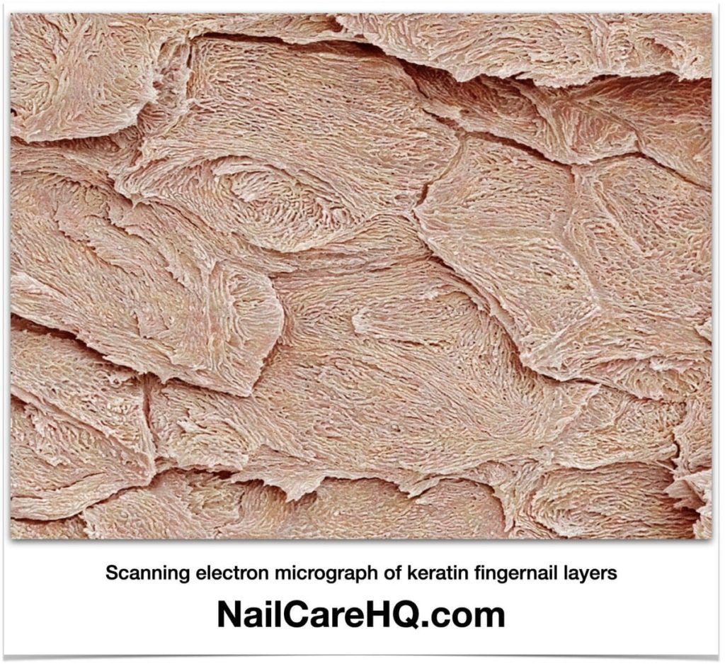 Photo of scanning electron micrograph of keratin fingernail layers to demonstrate nail peeling. Nailcarehq.com