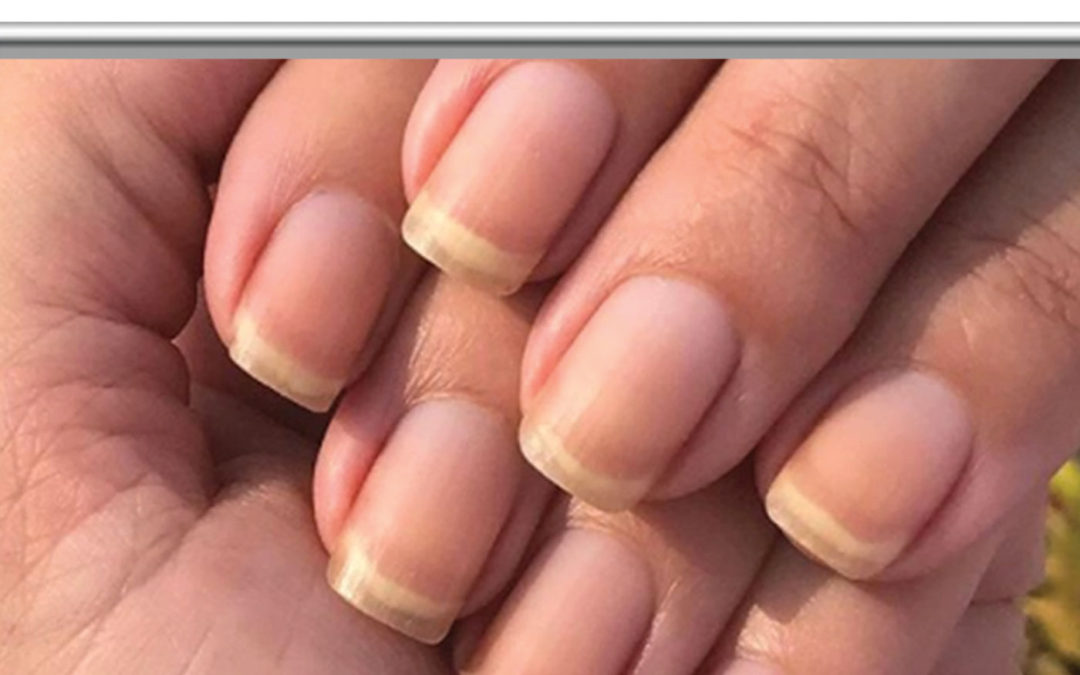 Quick Tips: Are Clear Nails Bad?